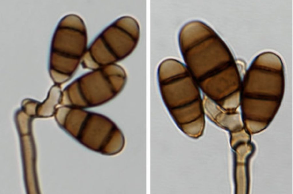 Microscopic view of Curvularia protuberata an endophytic fungus found in grasses.
